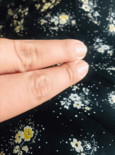 Close Up Fingers Black Floral Background GIF