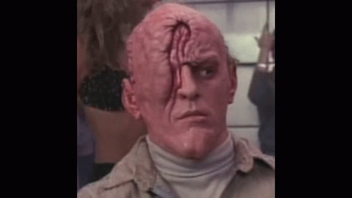 Close Up Man Face With Large Hole