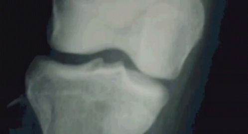 Close Up of Cat Nose and Eyes