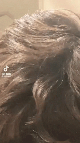 Close Up of Person's Hair With TikTok Logo