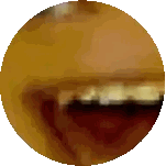 Close Up of Person's Mouth and Teeth