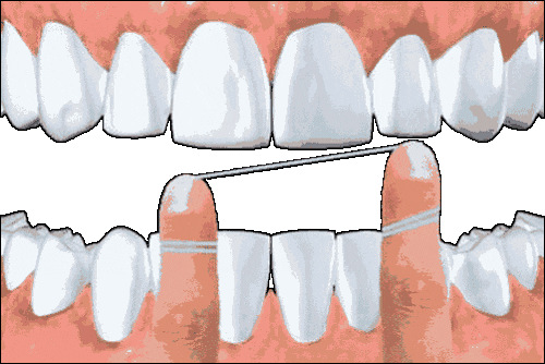 Dental Floss Animation GIF
