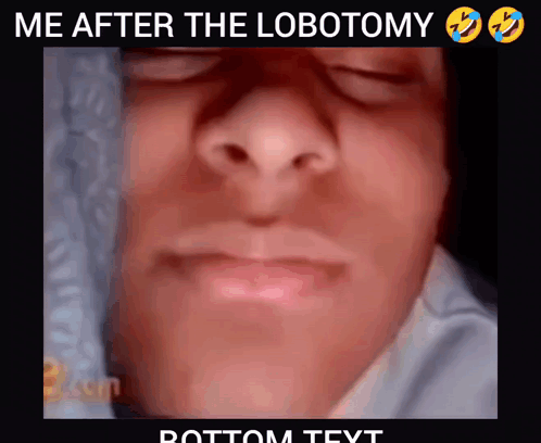Face Saying Me After The Lobotomy
