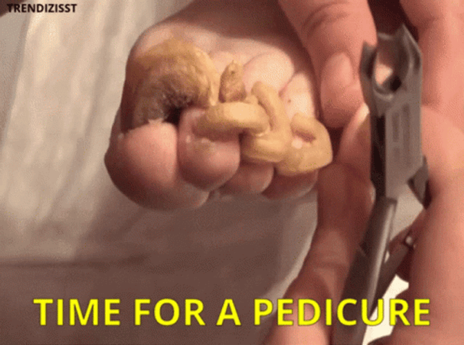 Feet In Need Of Pedicure GIF