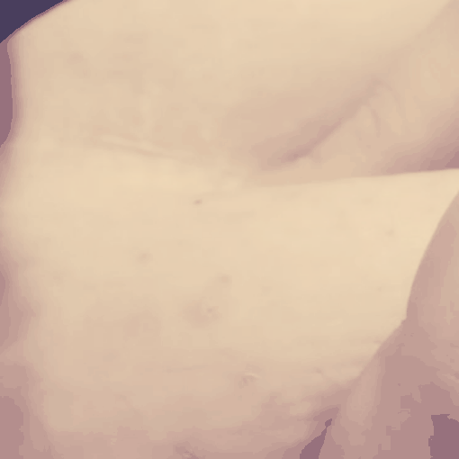 Fertility Injection Shots GIF