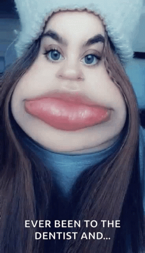 Funny Woman Saying Ever Been To Dentist And GIF
