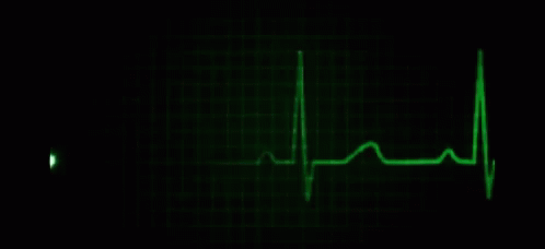 Green Heartbeat Monitor With Heartbeat Line GIF