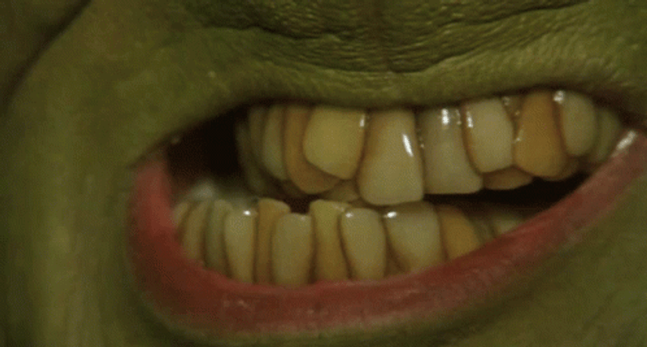 Grinch Infected British Teeth GIF