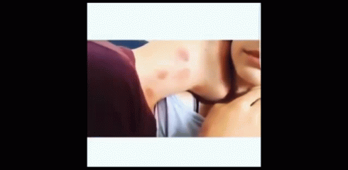 Guy Covered With Hickey Kisses GIF