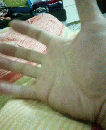 Close Open Hand Exercise GIF