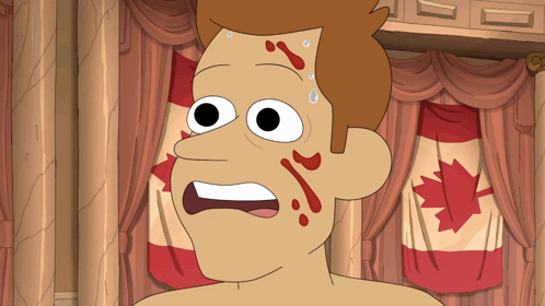 Inside Job Bloody Face Brett Hand GIF