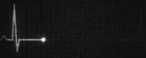 It Is A Black And White Image Of A Heartbeat . GIF
