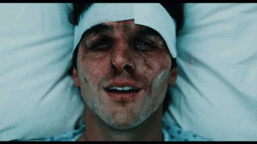 Jacob Elordi Smiling Beat Up Face Close Up GIF