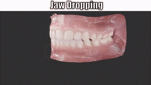 Jaw Dropping Mouth