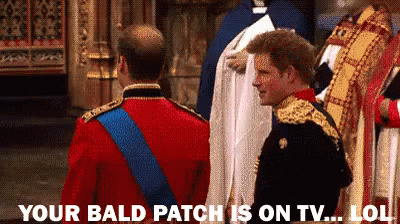 Joke Over Head Prince Harry Meme GIF