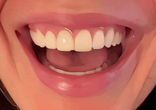 Kendall Jenner Tooth Meme GIF