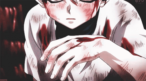 Killua Zoldyck Covered In Blood GIF