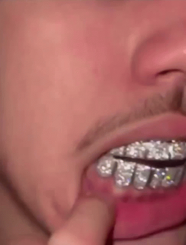 Lamelo Ball Showing Diamond Teeth GIF