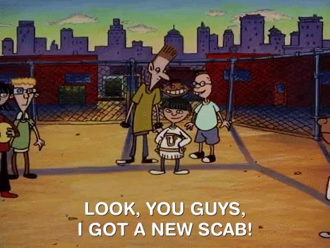 Look You Guys Got New Scab GIF