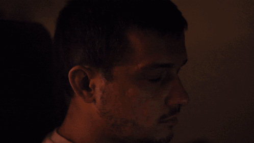 Man Bleeding From Face GIF