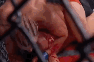 Man Laying on Top of Another in Cage