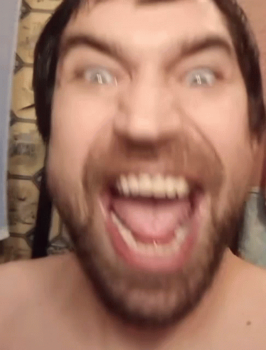 Man Making Funny Face with Teeth