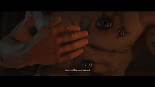 Man Talking To Chaplin Who Survived Rubicon Surgery GIF