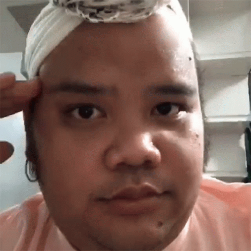 Man With Bandage on Head Looking at Camera