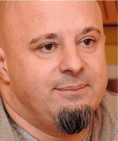 Man with Beard and Bald Head