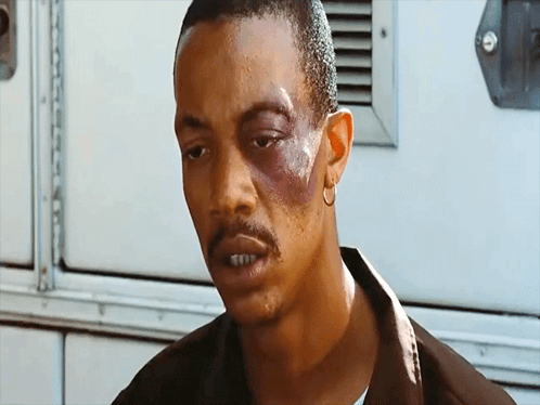 Man With Black Eye And Hoop Earrings GIF