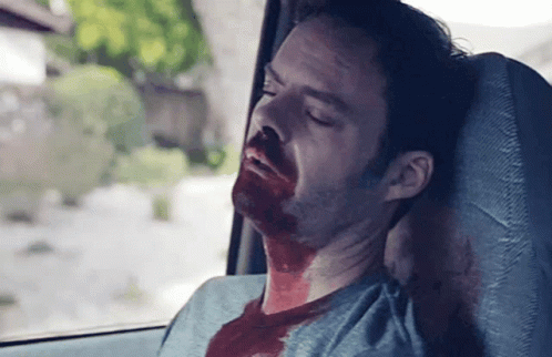 Man With Blood on Face Laying in Car
