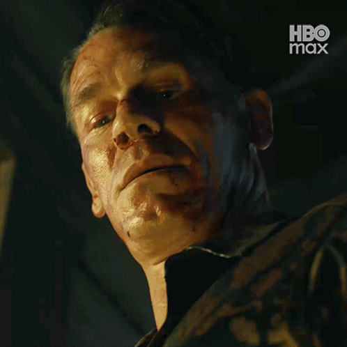 Man With Bloody Face Ready For The Next GIF