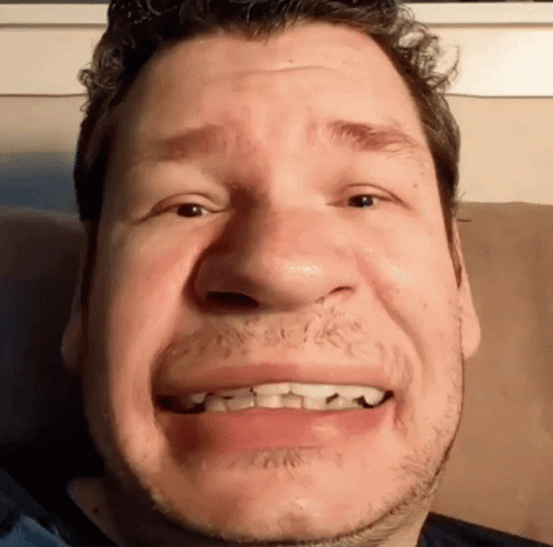 Man With Braces Smiling Funny Face GIF
