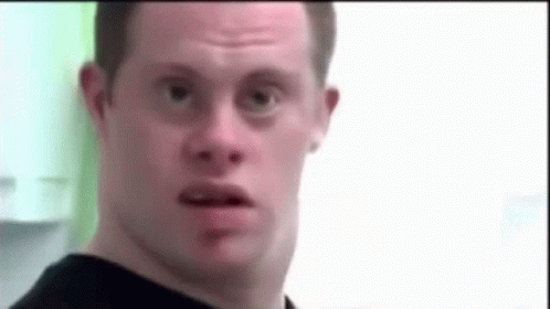 Man With Down Syndrome Funny Face GIF