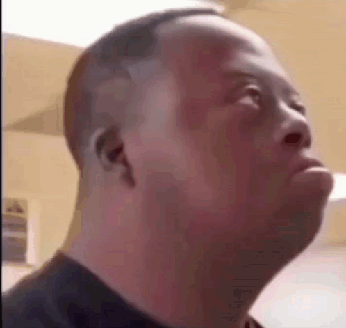 Man With Down Syndrome Making Funny Face GIF