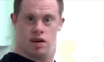 Man With Down Syndrome Making Funny Face GIF