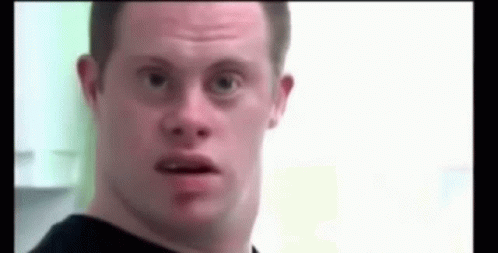 Man With Down Syndrome Making Funny Face GIF