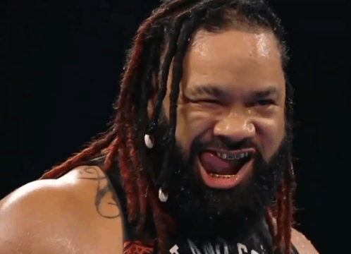 Man With Dreadlocks And Braces GIF