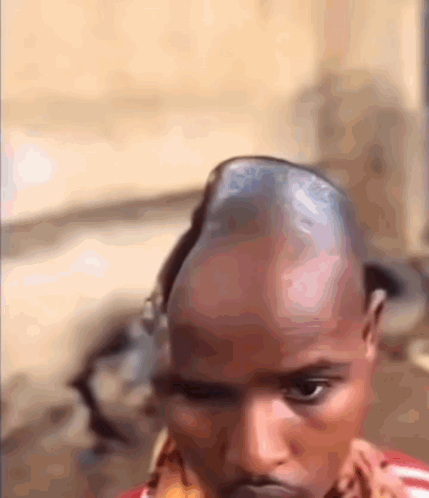 Man With Large Bump on Head
