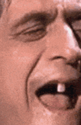 Man With Missing Tooth and Open Mouth