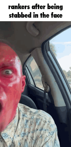 Man with Red Spots in Car Saying Rankers
