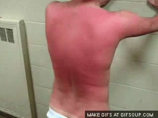 Man with Red Spots Standing