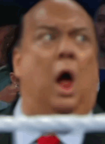 Man with Surprised Face