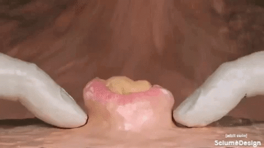 Massive Pimple Person Popping Out Clay Animation GIF