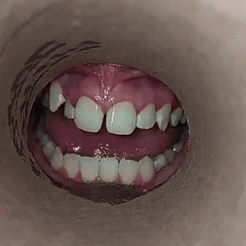 Mouth Showing Teeth