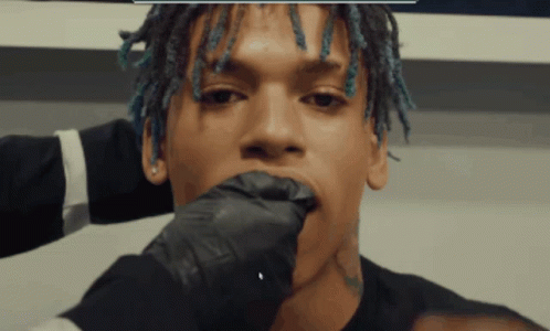 Nle Choppa Dental Visit GIF