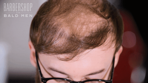 Northern Ireland Bald Man GIF