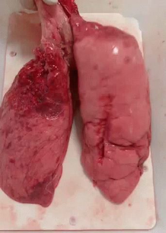 One Part Lungs Breathe GIF