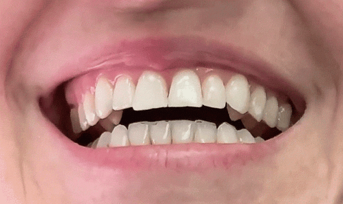 Perfect Smile Teeth GIF | GIFDB.com