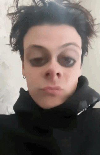 Person's Face With Black Eye Circles